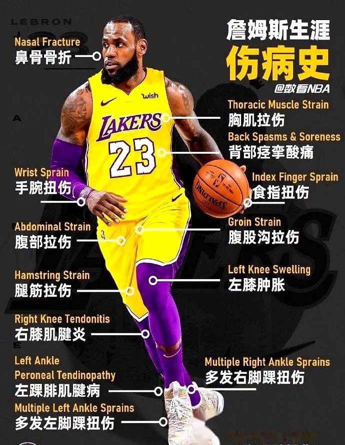 包含詹姆斯再度缺战,湖人铁血核心缺阵对球队影响深远的词条 包含詹姆斯再度缺战,湖人铁血核心缺阵对球队影响深远的词条
